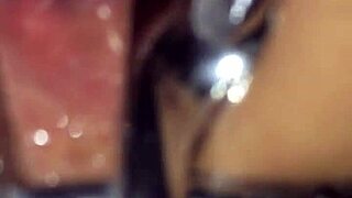 Shemale Uses Speculum Anal