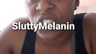 I have a penial yeast infection and it's really bothering me